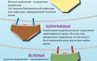 Патологические вагинальные выделения без зуда