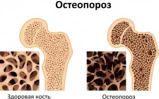 Способы безопасного употребления щавеля при беременности