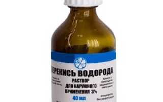 Пробка в ухе