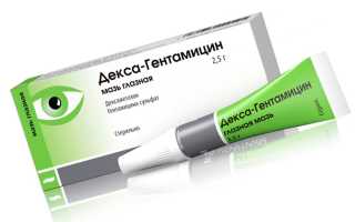 Причины развития ретробульбарного неврита зрительного нерва — методы лечения