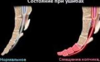 Боли в копчике во время беременности