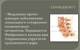 Основные причины хруста в шее и как от него избавиться