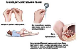 Глицериновые свечи во время беременности: польза или вред